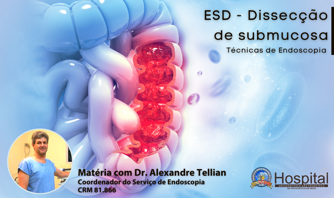 Técnicas de Endoscopia: ESD – Dissecção de submucosa