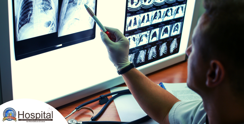 Dia do médico radiologista: especialista do HUSF explica detalhes da profissão